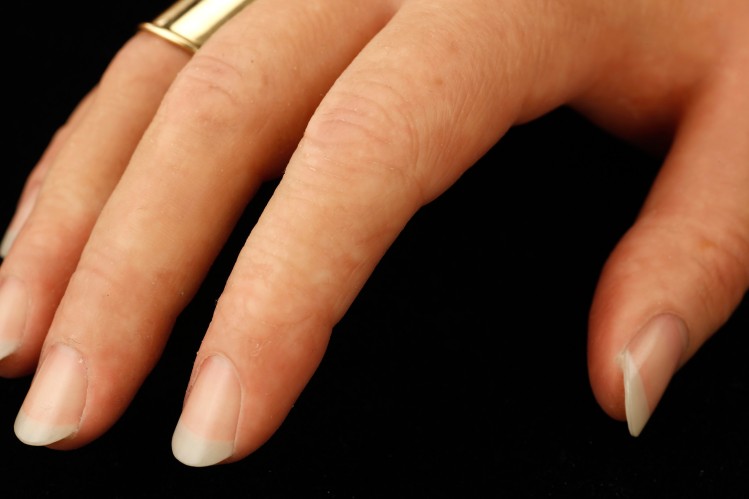 Close-up of right cosmetic hand, with nails and ring visible.